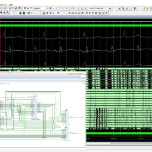 Extraction of Fetal ECG