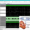 Invasive RLS-Based Fetal ECG Extraction