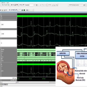 Invasive RLS-Based Fetal ECG Extraction