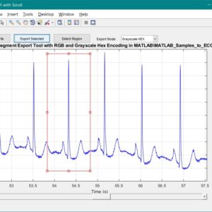 ECG Segment Export Tool