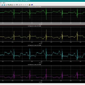 CMOS ECG Low Pass Filter