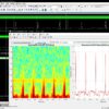 ECG_Spectrogram