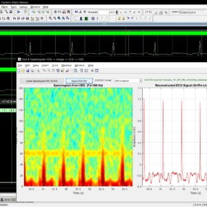 ECG_Spectrogram