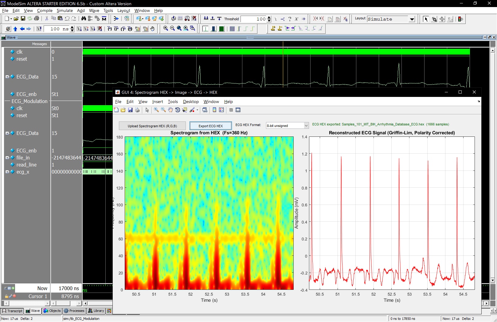 ECG_Spectrogram ECG_Spectrogram